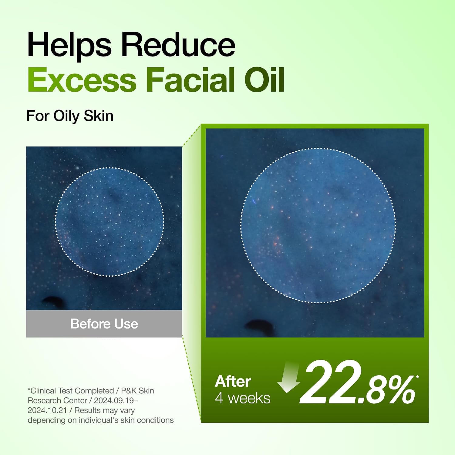 Anua Azelaic Acid 10 Hyaluron Redness Soothing Serum, 1.01 fl oz