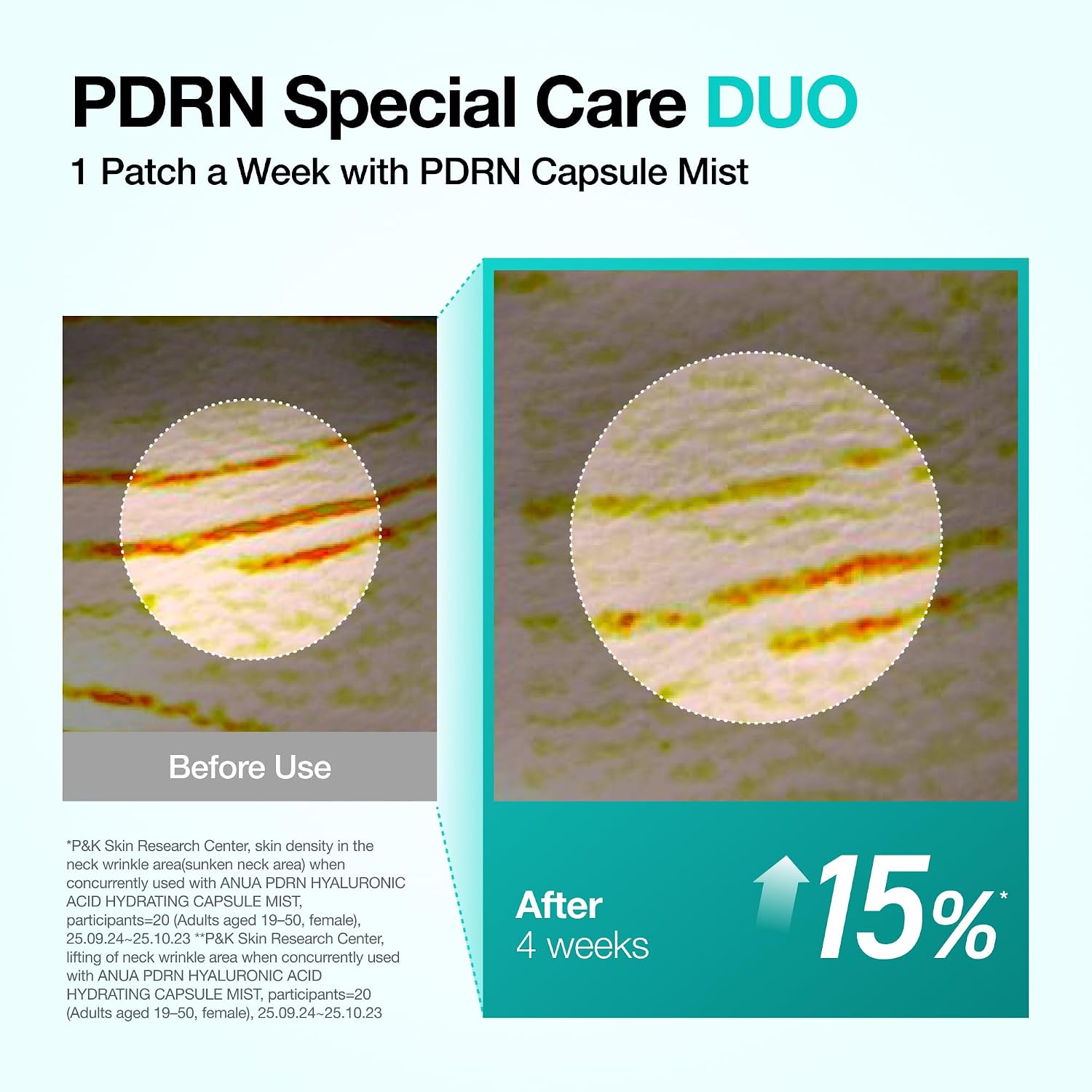 Anua PDRN Collagen Melting Patch for Neck, 0.02g x 4ea