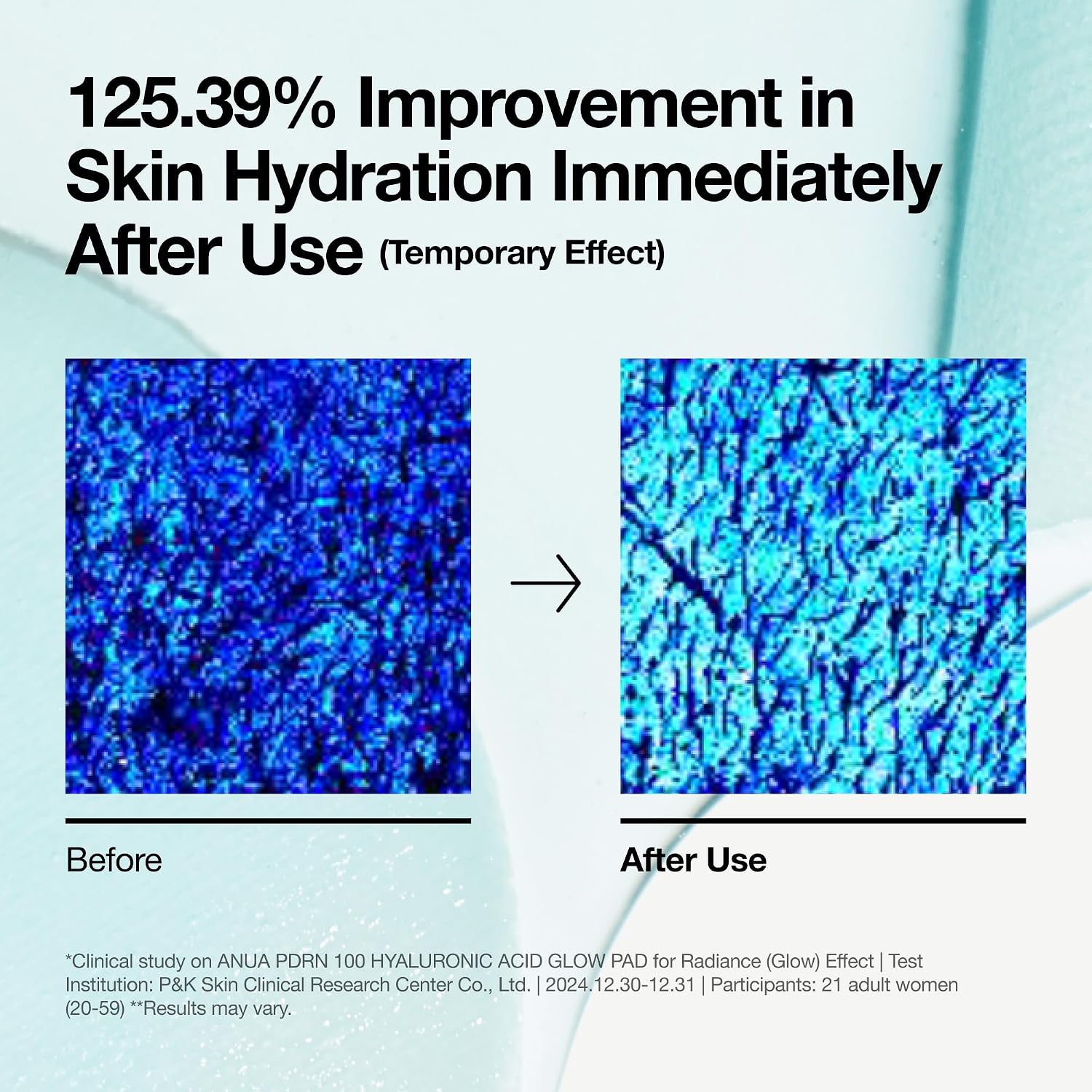 Anua PDRN 100 Hyaluronic Acid Toner Pad, 6.1 fl oz, 60 Count