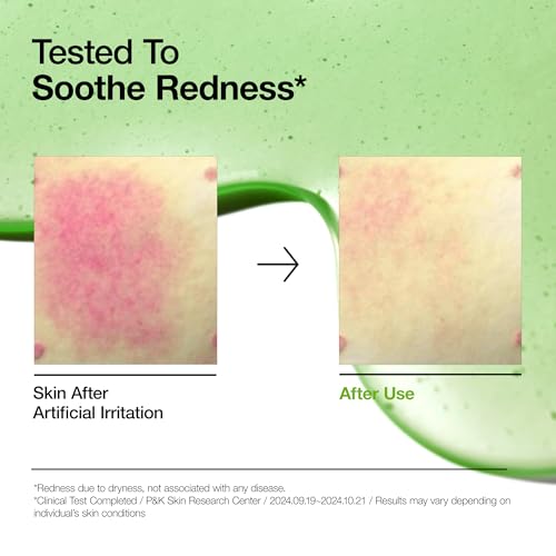 Anua Azelaic Total Soothing Trio