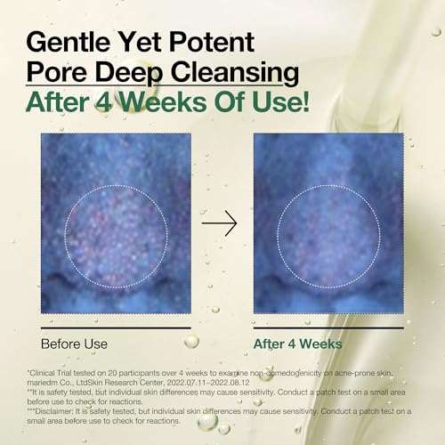 Auna Deep Pore Treatment Duo