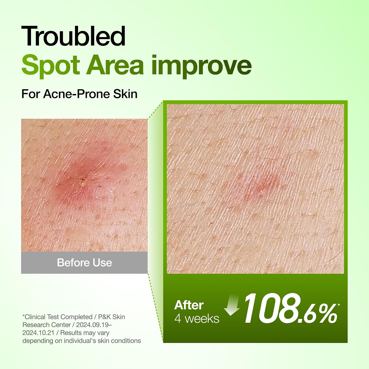Anua Spot Correcting & Clarity Duo