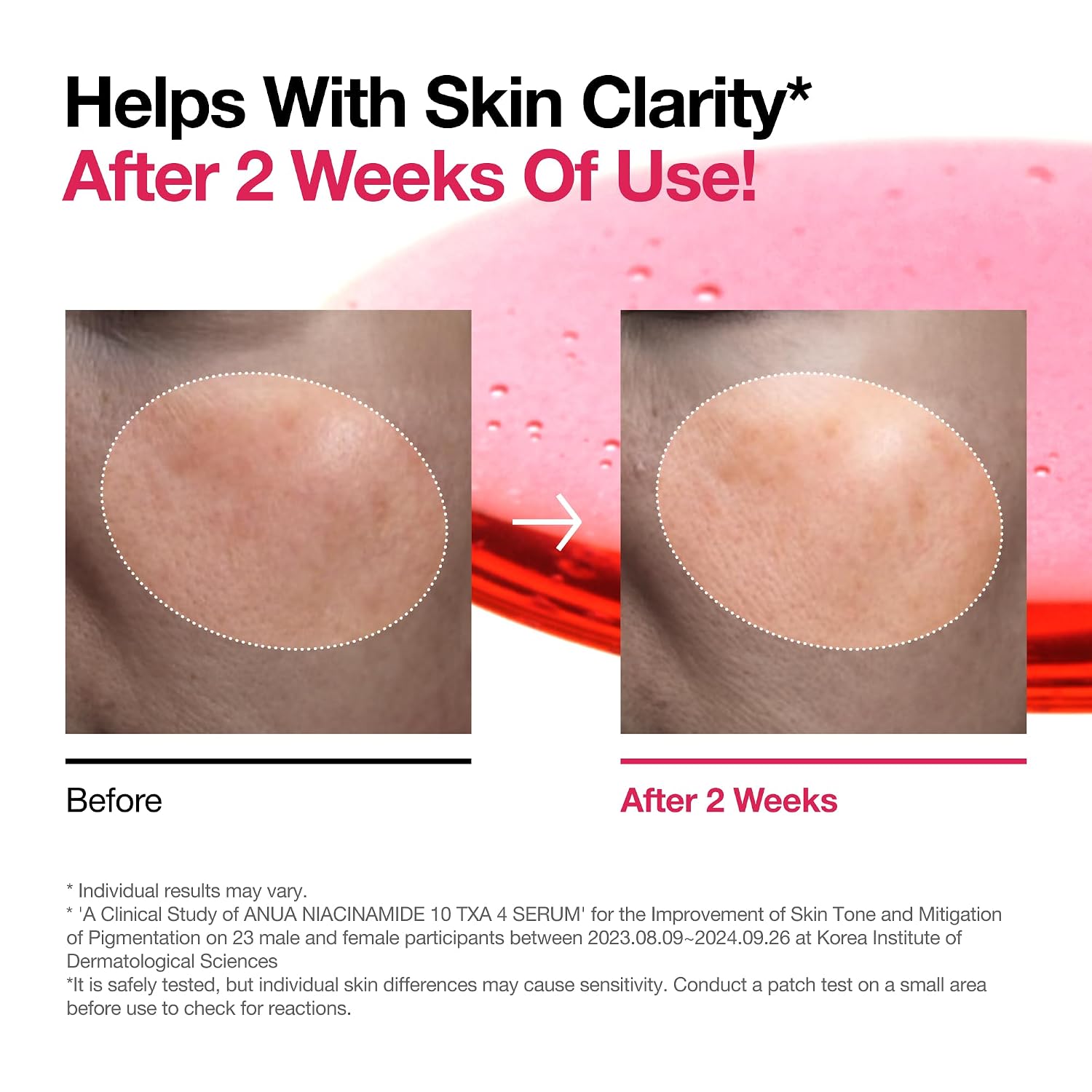 Anua 2% BHA + 10% Niacinamide Skin Booster Duo