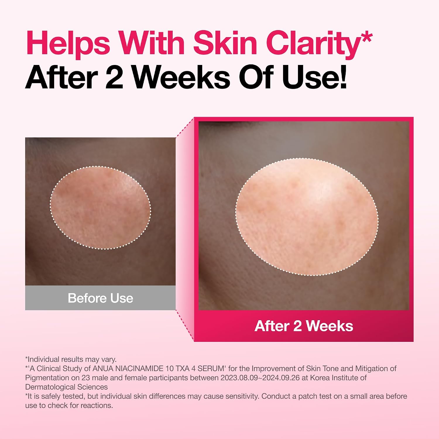 Anua Retinol & TXA Care Duo